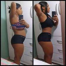 Antes e Depois de Usuária 2